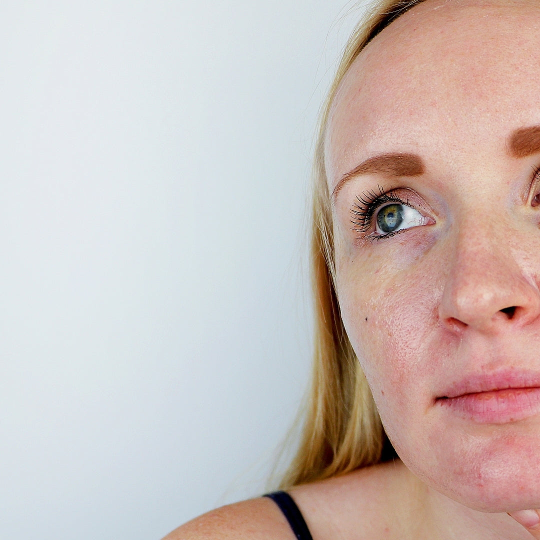 Oily Skin